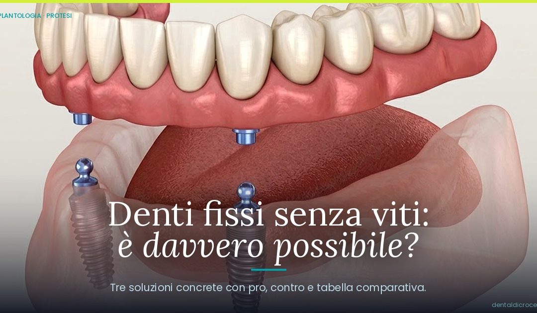 Denti Fissi Senza Viti a Pescara | Ponte, Overdenture o Full-Arch | Dr. Di Croce