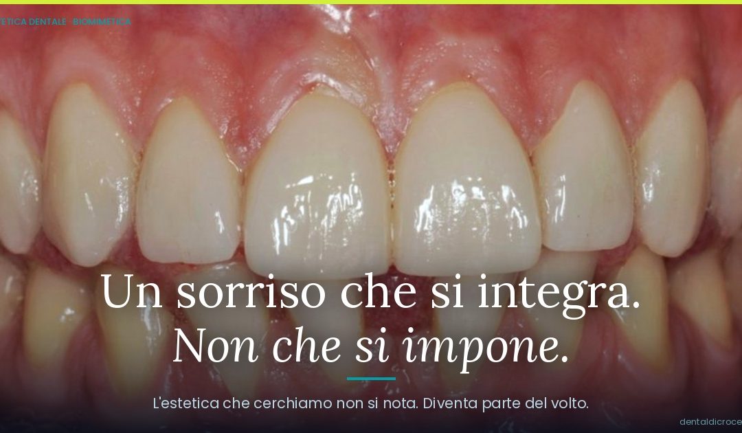 Estetica dentale e naturalezza: quando un sorriso si integra nel volto