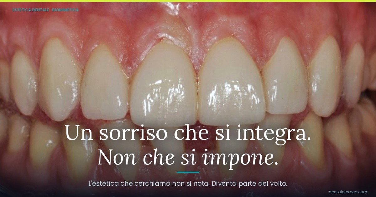 Close-up of a smile showing upper teeth and gums; Italian dental ad about an integrated, non-imposing smile.