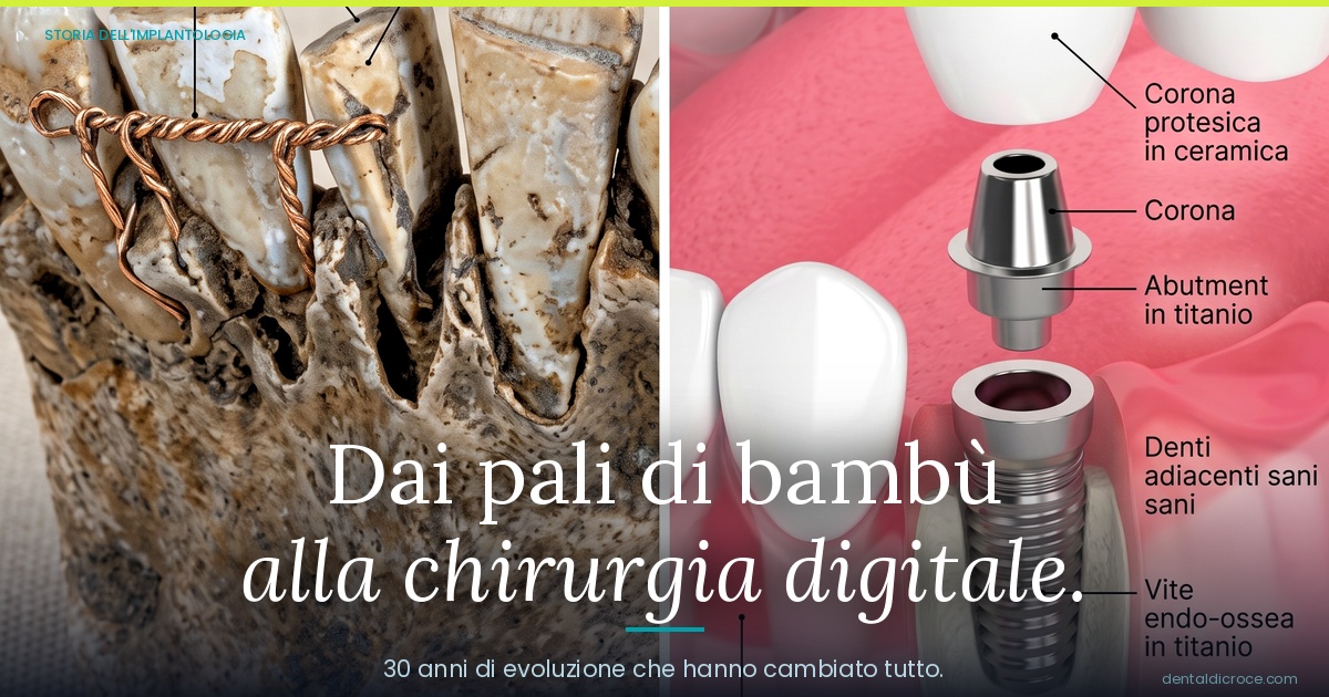 Split image showing a decayed tooth structure on the left and dental implant components on the right, illustrating the evolution of dental implants in Italy’s context.