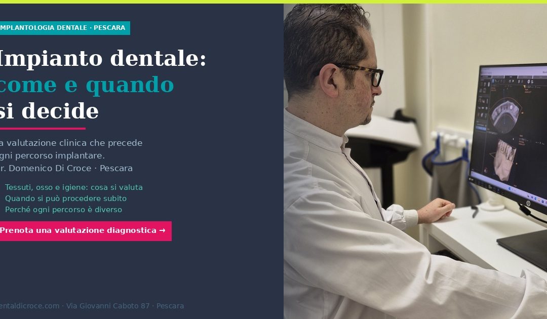 Impianto dentale: come e quando si decide