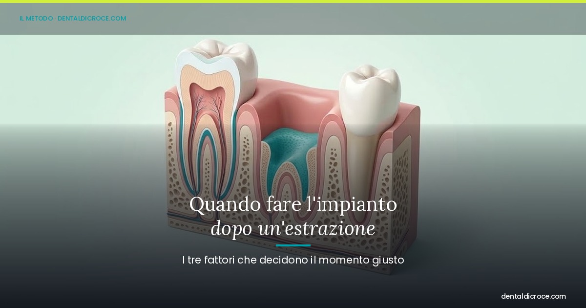 Cross‑sectional dental model showing tooth and jaw anatomy; article title about when to place a dental implant after extraction.