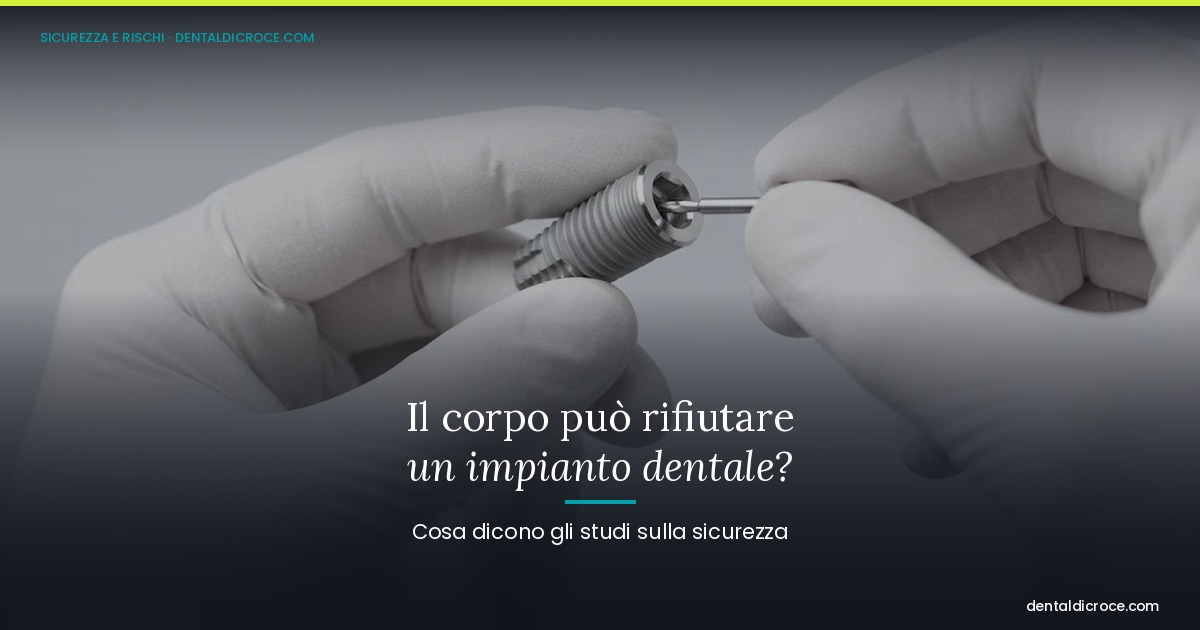 og-rigetto-impianto-dentale Gloved hands assemble a dental implant, illustrating an article about implant safety and rejection.