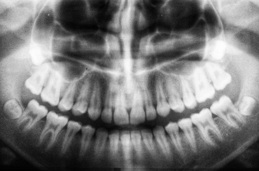Quello che non si vede in uno studio dentistico: diagnosi, pianificazione e lavoro clinico
