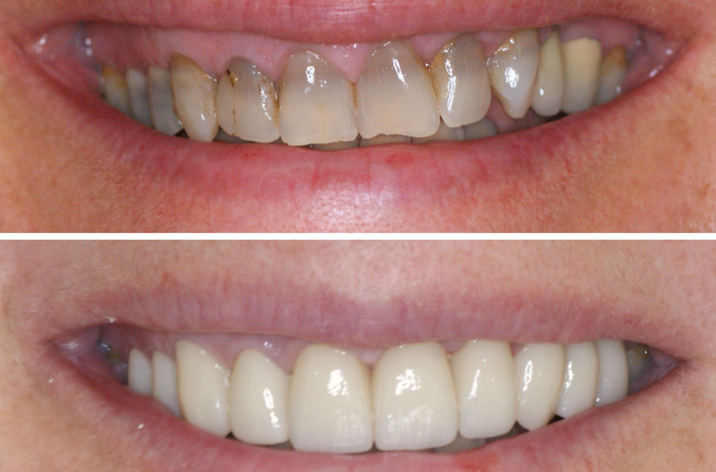 Estetica dentale e naturalezza: quando un sorriso si integra nel volto
